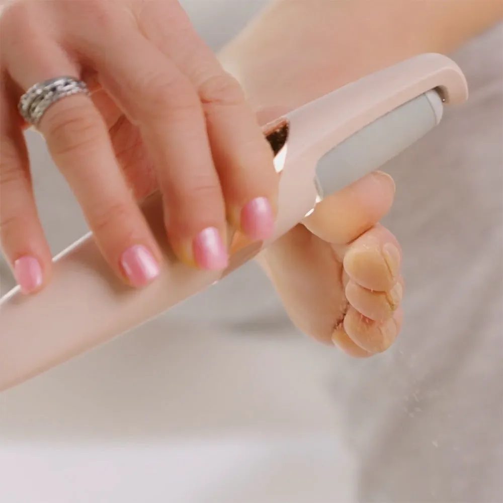 The Foot Callus Remover