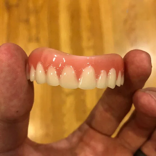 Perfect Smile Veneer (Upper & Lower)