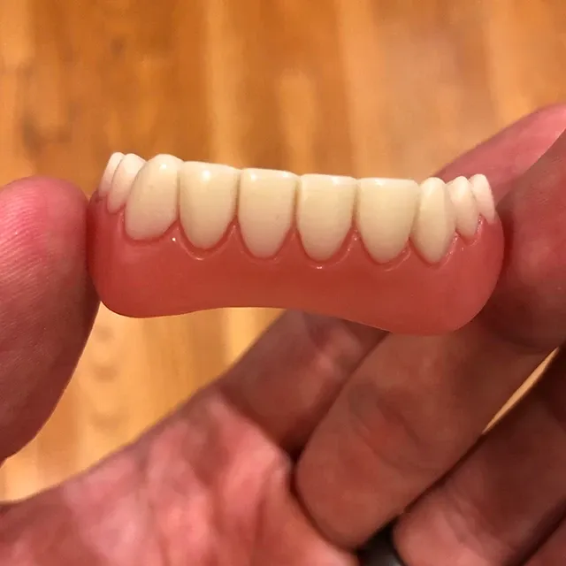 Perfect Smile Veneer (Upper & Lower)