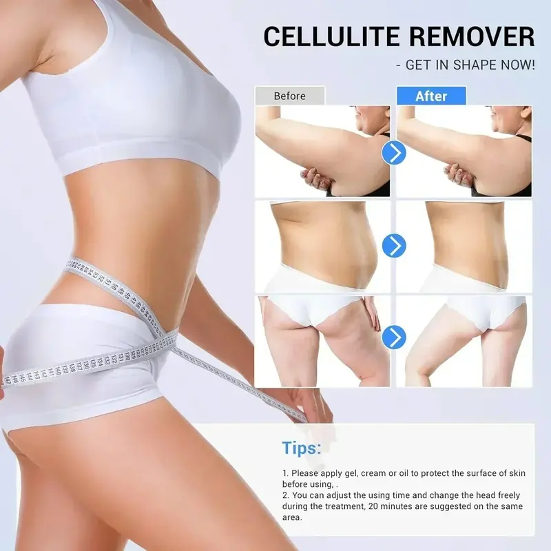 RF Cellulite Massager – At-Home Radiofrequency Device for Smoother Skin Texture