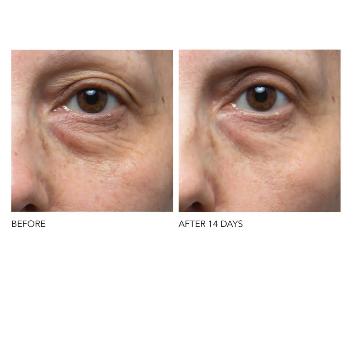 Dr Dennis Gross Ferulic + Retinol Eye Cream (0.5 oz)