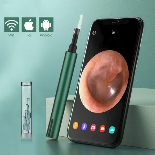 Ear Wax Removal Tool With WiFi Camera