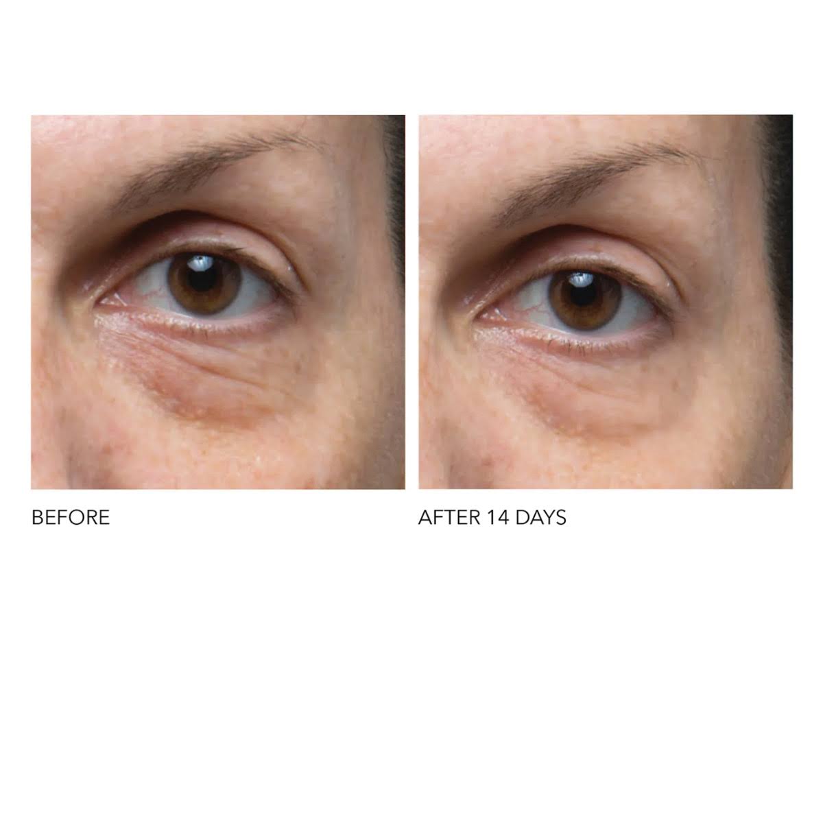 Dr Dennis Gross Ferulic + Retinol Eye Cream (0.5 oz)