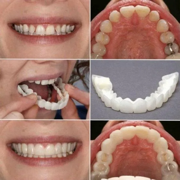 Premium Snap-On Dentures Kit