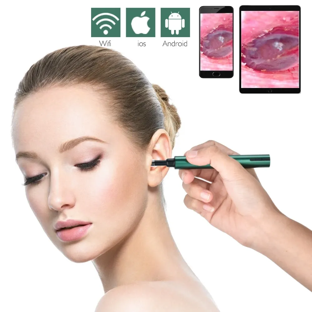 Ear Wax Removal Tool With WiFi Camera