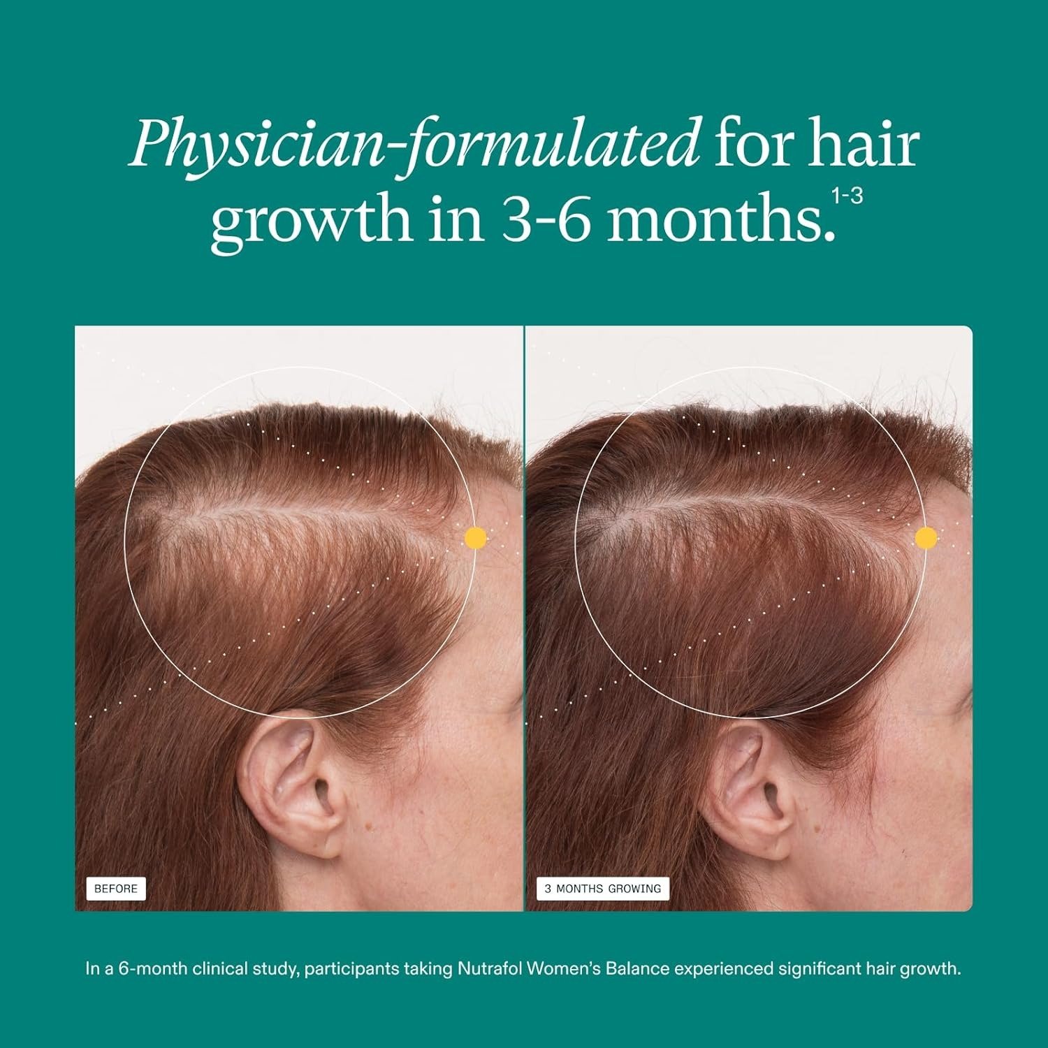 Women’s Balance Hair Growth Supplements, Ages 45 and Up, Clinically Proven for Visibly Thicker Hair and Scalp Coverage, Dermatologist Recommended – 1 Month Supply