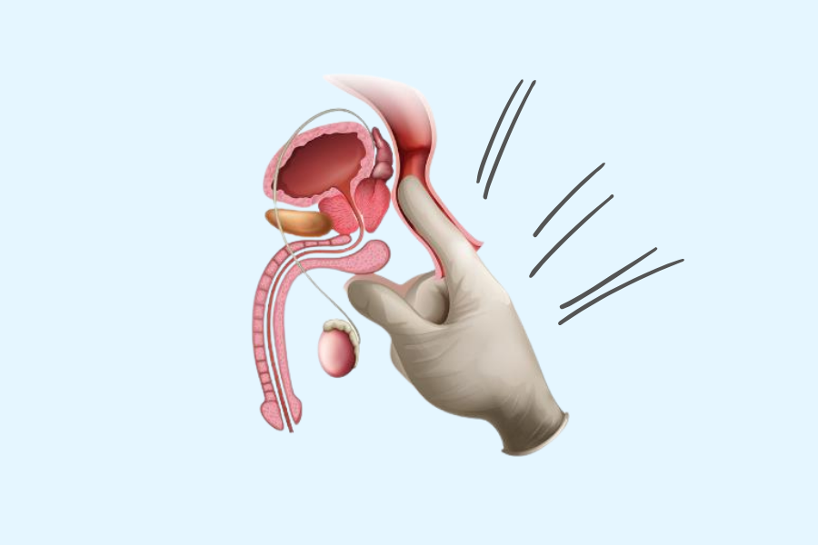 前立腺 マッサージ 体験