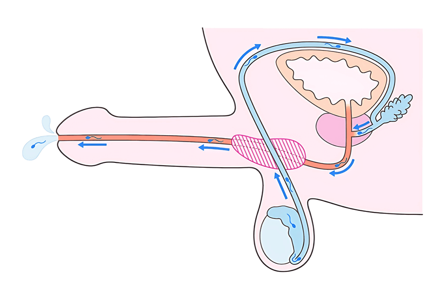 ドライオーガズムとは