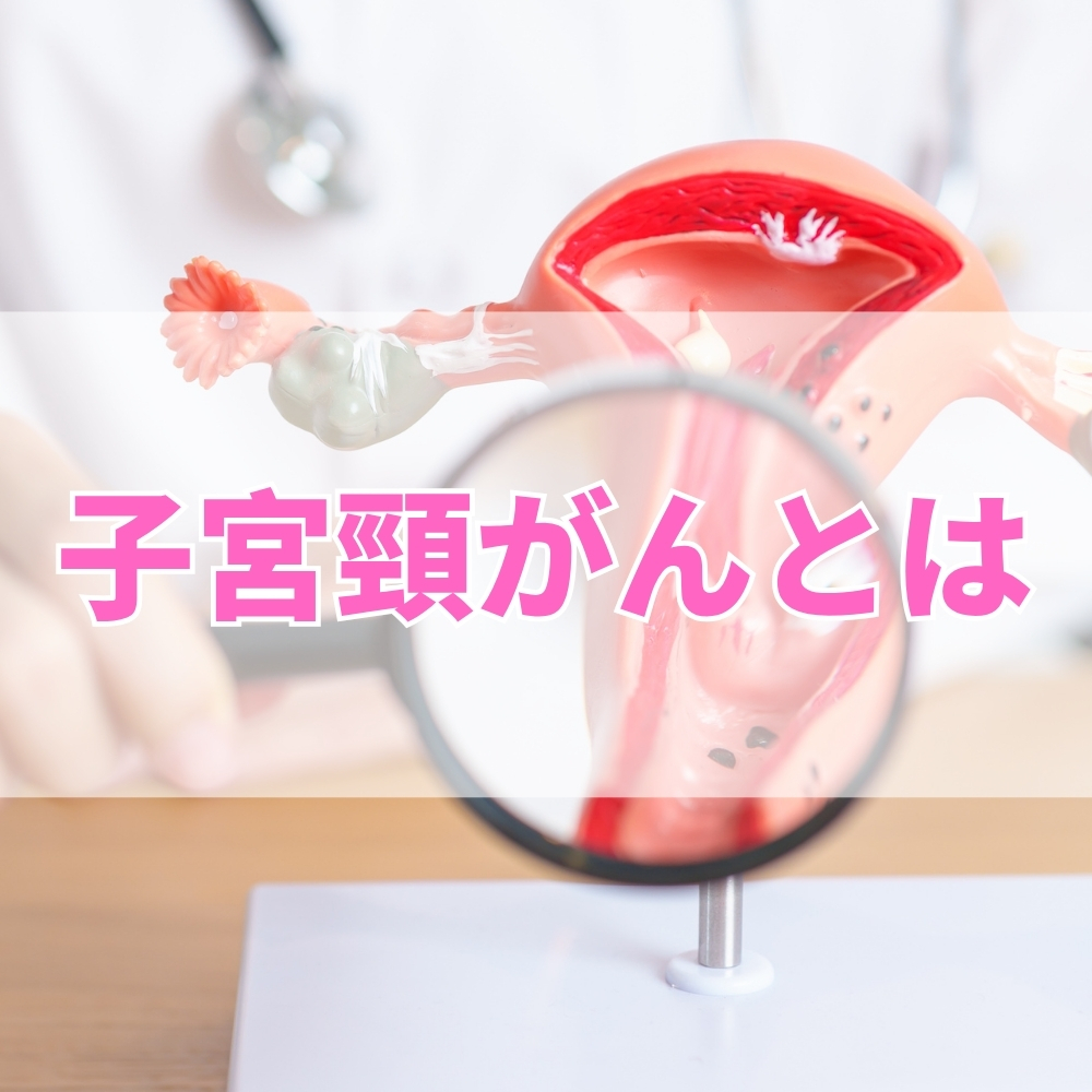 子宮頸がん（しきゅうけいがん）とは