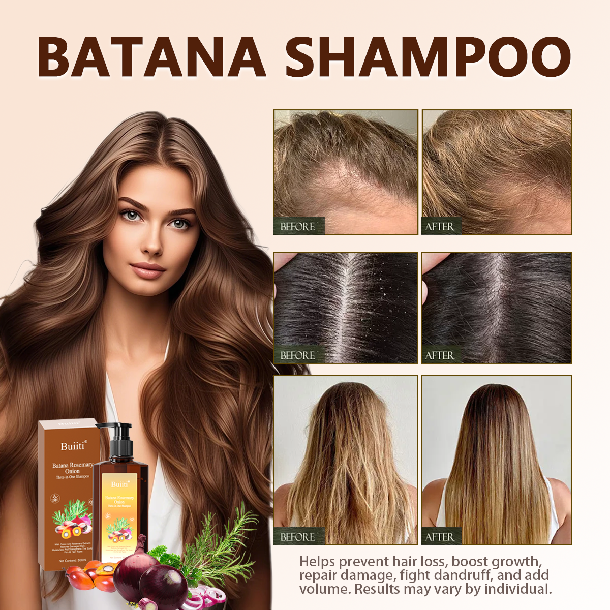 Buiiti Batana Rosemary & Onion 3-in-1 Shampoo – For All Hair Types | Nourishes, Strengthens, and Promotes Natural Hair Growth | Thickening & Comforting Haircare