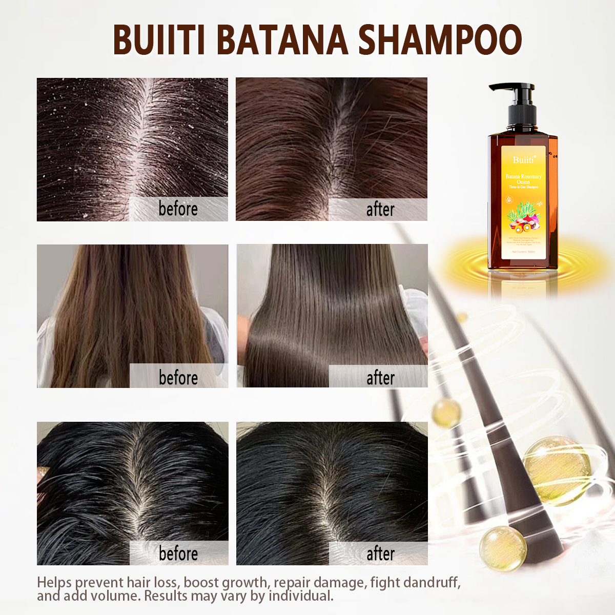 Buiiti Batana Rosemary & Onion 3-in-1 Shampoo – For All Hair Types | Nourishes, Strengthens, and Promotes Natural Hair Growth | Thickening & Comforting Haircare