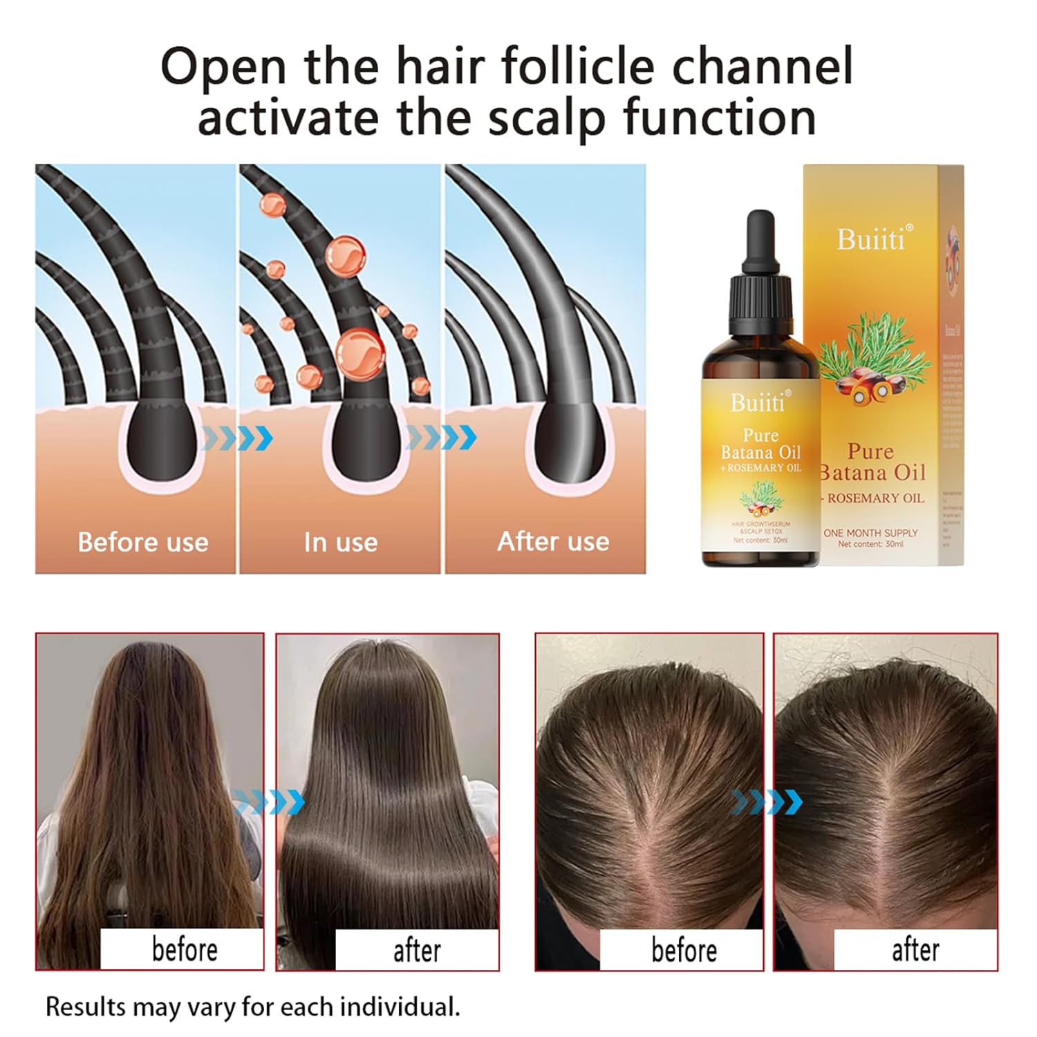 Batana Oil with Rosemary for Hair Growth - 100% Organic from Honduras - Reduce Hair Loss & Detox Your Scalp (30 mL)