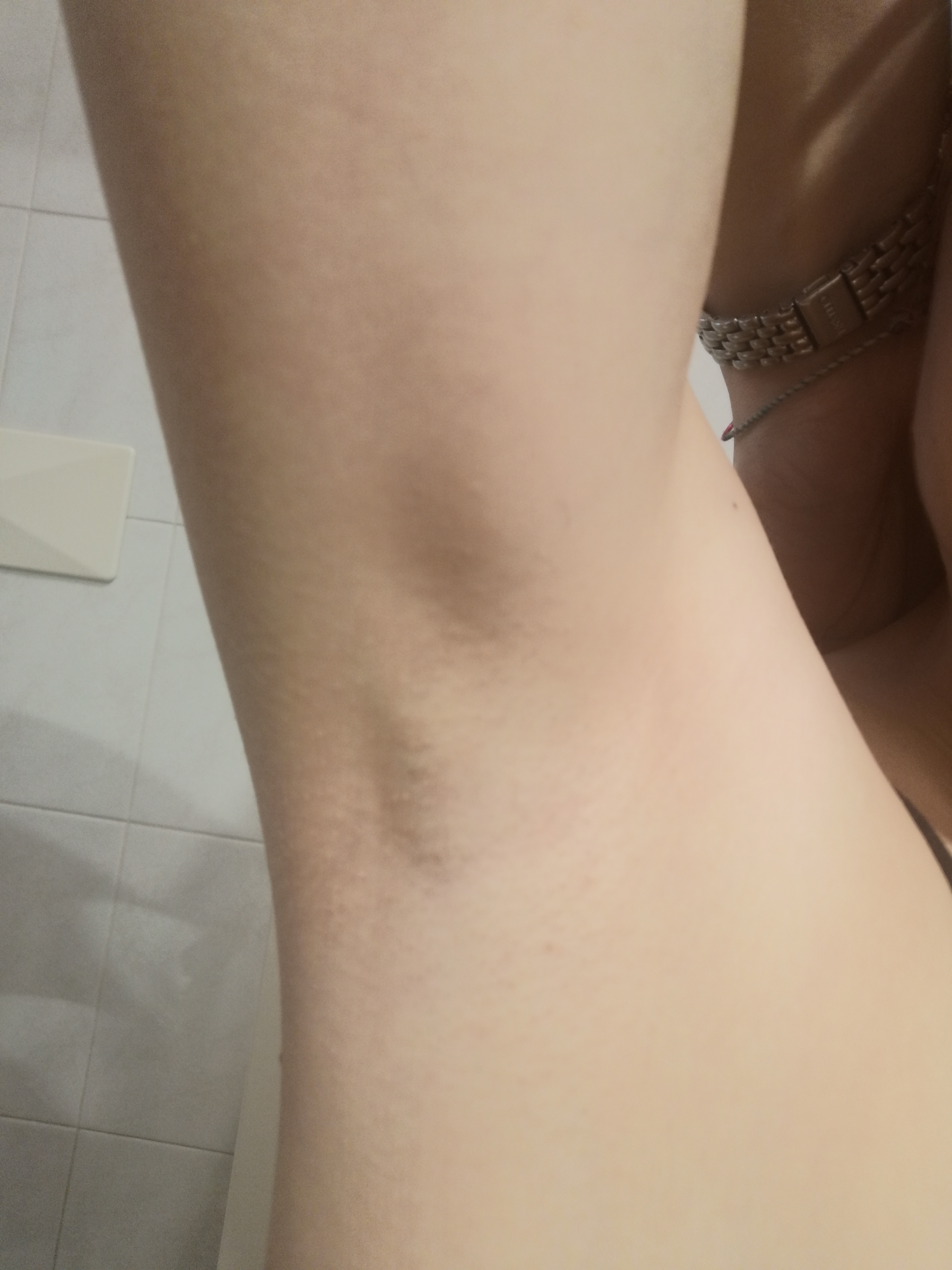 Philips Lumea 8000 Series IPL Painless Fast Hair Removal Device with SenseIQ Technology, 4 Attachments for Body, Face, Bikini and Underarms, Satin Compact Pen Trimmer, Model BRI949/00《NO8》