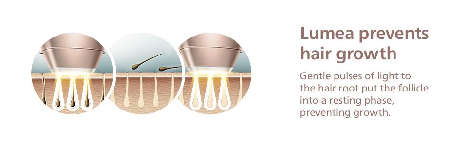 Philips Lumea 8000 Series IPL Painless Fast Hair Removal Device with SenseIQ Technology, 4 Attachments for Body, Face, Bikini and Underarms, Satin Compact Pen Trimmer, Model BRI949/00《NO8》